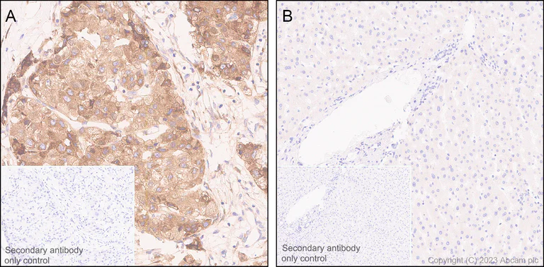 Immunohistochemistry (Formalin/PFA-fixed paraffin-embedded sections) - Anti-PLOD2/LH2 antibody [EPR25160-20] - BSA and Azide free (AB313766)