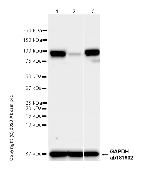 Western blot - Anti-PLOD2/LH2 antibody [EPR25160-20] - BSA and Azide free (AB313766)
