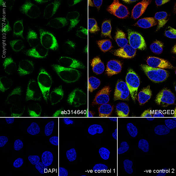 Immunocytochemistry/ Immunofluorescence - Anti-PLOD2/LH2 antibody [EPR25160-22] - BSA and Azide free (AB314641)