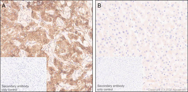 Immunohistochemistry (Formalin/PFA-fixed paraffin-embedded sections) - Anti-PLOD2/LH2 antibody [EPR25160-22] - BSA and Azide free (AB314641)