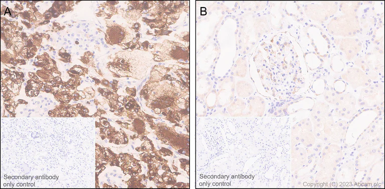 Immunohistochemistry (Formalin/PFA-fixed paraffin-embedded sections) - Anti-PLOD2/LH2 antibody [EPR25160-22] - BSA and Azide free (AB314641)