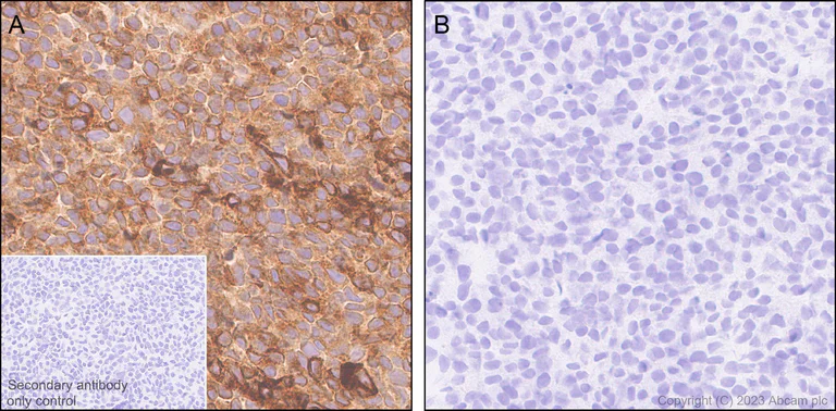 Immunohistochemistry (Formalin/PFA-fixed paraffin-embedded sections) - Anti-PLOD2/LH2 antibody [EPR25160-22] - BSA and Azide free (AB314641)