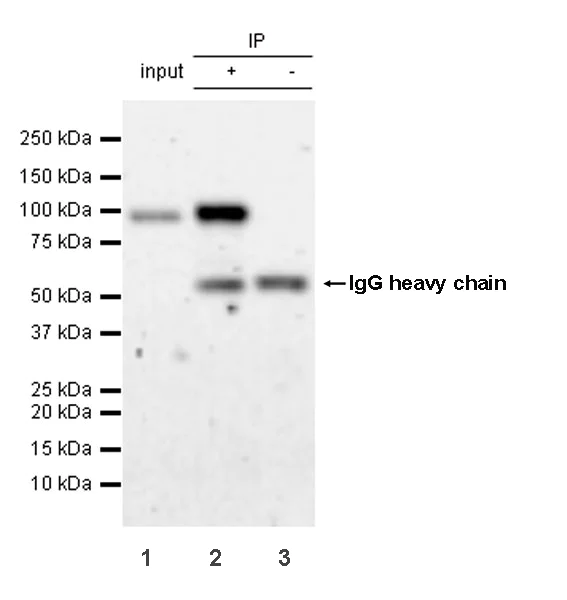 Immunoprecipitation - Anti-PLOD2/LH2 antibody [EPR25160-22] - BSA and Azide free (AB314641)