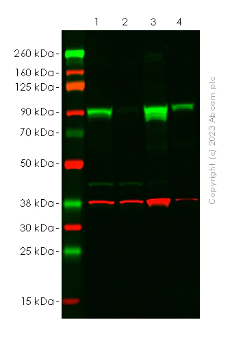 Western blot - Anti-PLOD2/LH2 antibody [EPR25160-22] - BSA and Azide free (AB314641)