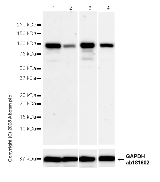 Western blot - Anti-PLOD2/LH2 antibody [EPR25160-22] - BSA and Azide free (AB314641)
