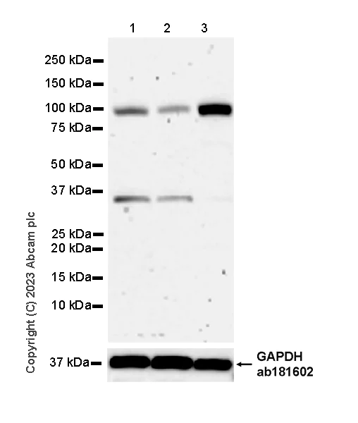 Western blot - Anti-PLOD2/LH2 antibody [EPR25160-22] - BSA and Azide free (AB314641)