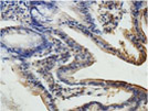 Immunohistochemistry (Formalin/PFA-fixed paraffin-embedded sections) - Anti-PLOD3 antibody (AB128698)