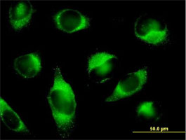 Immunocytochemistry/ Immunofluorescence - Anti-PLOD3 antibody (AB89263)