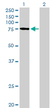 Western blot - Anti-PLOD3 antibody (AB89263)