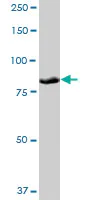 Western blot - Anti-PLOD3 antibody (AB89263)