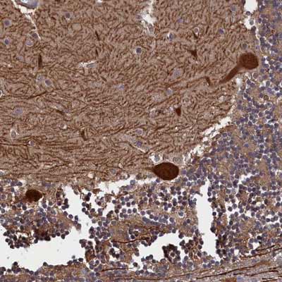 Immunohistochemistry (Formalin/PFA-fixed paraffin-embedded sections) - Anti-PLP2 antibody (AB122792)