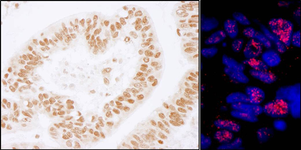 Immunohistochemistry (Formalin/PFA-fixed paraffin-embedded sections) - Anti-PLRG1 antibody (AB86050), expandable thumbnail