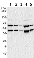 Western blot - Anti-PLRG1 antibody (AB86050)