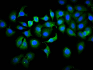Immunocytochemistry/ Immunofluorescence - Anti-PLS1 antibody (AB236976)