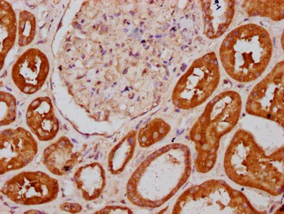 Immunohistochemistry (Formalin/PFA-fixed paraffin-embedded sections) - Anti-PLS1 antibody (AB236976)