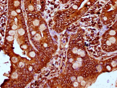 Immunohistochemistry (Formalin/PFA-fixed paraffin-embedded sections) - Anti-PLS1 antibody (AB236976)