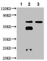 Immunoprecipitation - Anti-PLS1 antibody (AB236976)