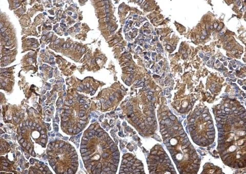 Immunohistochemistry (Formalin/PFA-fixed paraffin-embedded sections) - Anti-PLSCR4 antibody (AB228907)