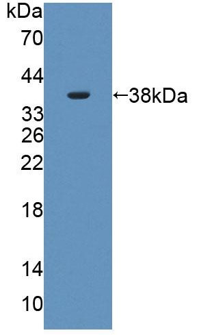 Western blot - Anti-PLSCR4 antibody (AB233005)