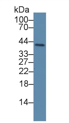 Western blot - Anti-PLSCR4 antibody (AB233005)