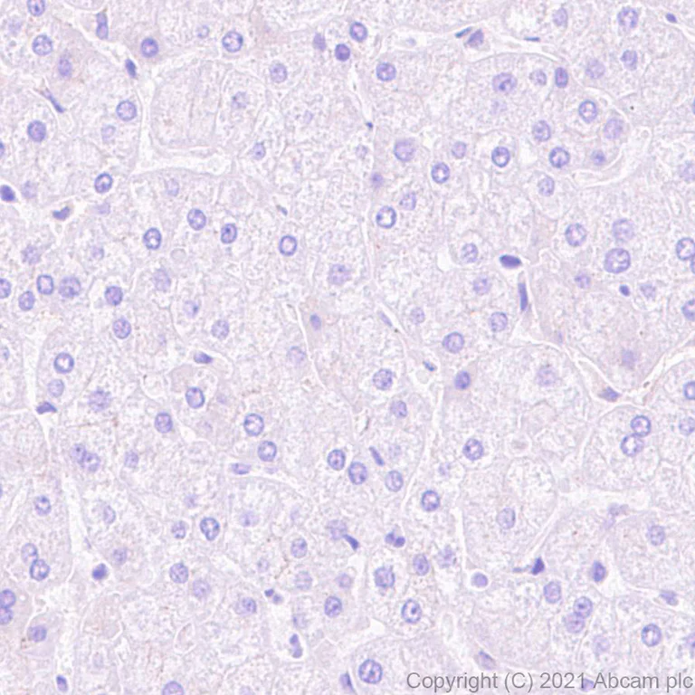 Immunohistochemistry (Formalin/PFA-fixed paraffin-embedded sections) - Anti-PLTP antibody [EPR24448-21] (AB282456)