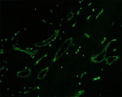 Immunocytochemistry/ Immunofluorescence - Anti-PLVAP/PV-1 antibody [174/2] (AB81719)