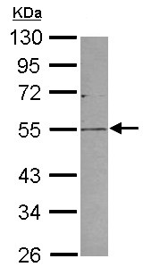 Western blot - Anti-PLVAP/PV-1 antibody (AB127554)