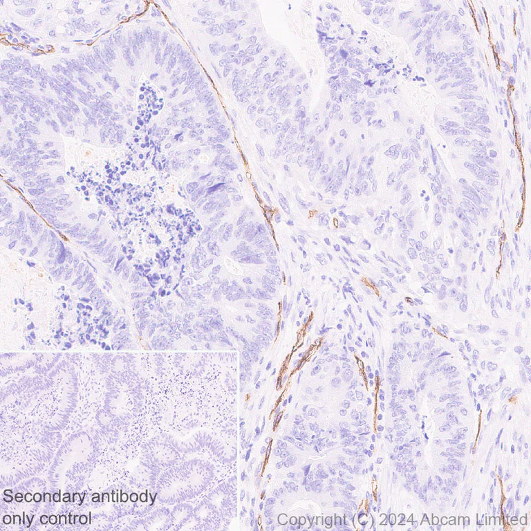 Immunohistochemistry (Formalin/PFA-fixed paraffin-embedded sections) - Anti-PLVAP/PV-1 antibody [EPR29045-558] (AB321889)