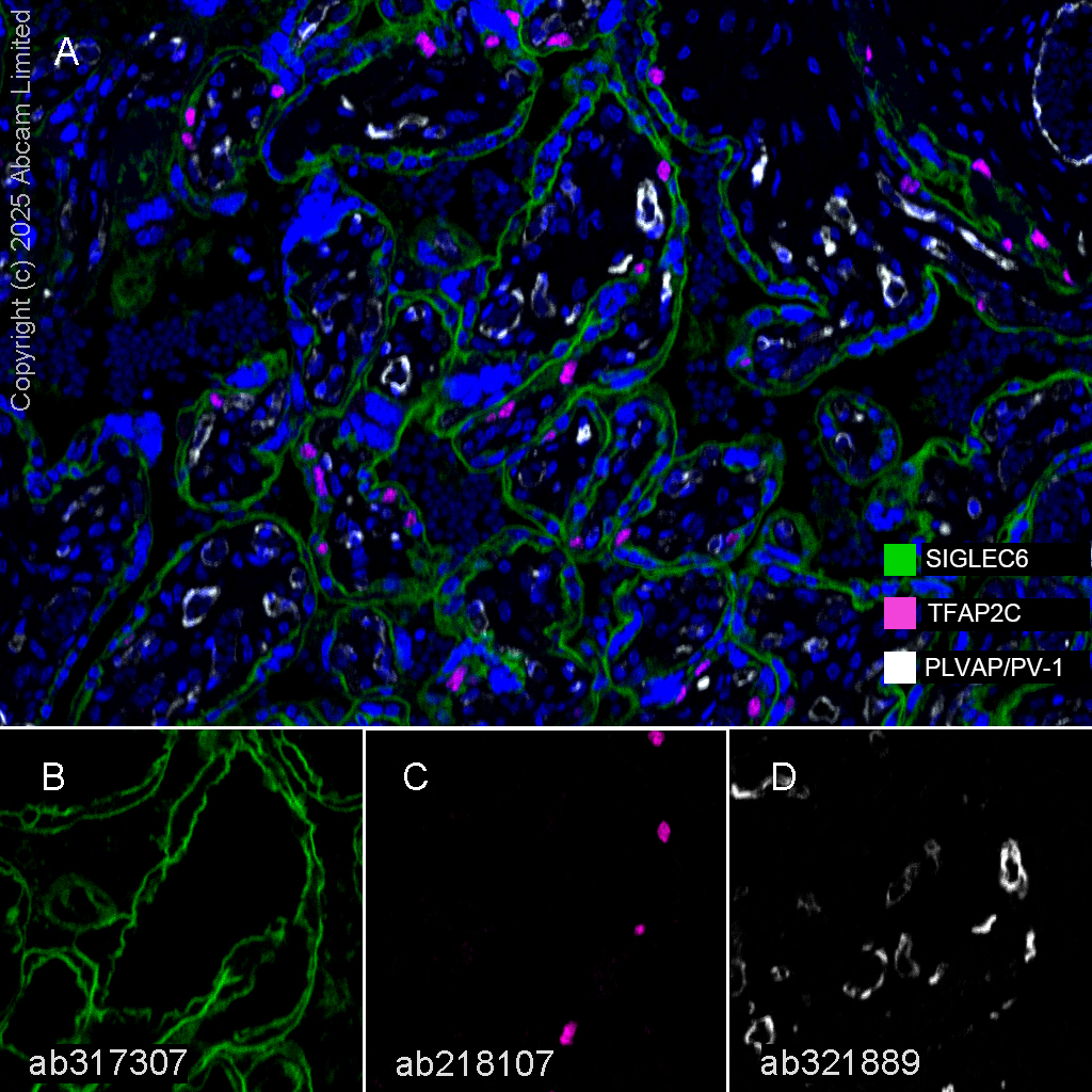 Multiplex immunohistochemistry - Anti-PLVAP/PV-1 antibody [EPR29045-558] (AB321889)