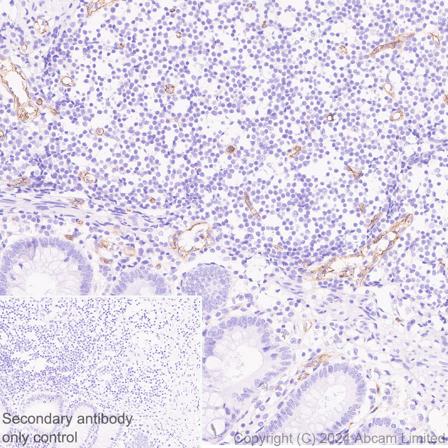 Immunohistochemistry (Formalin/PFA-fixed paraffin-embedded sections) - Anti-PLVAP/PV-1 antibody [EPR29045-558] - BSA and Azide free (ab321890), expandable thumbnail