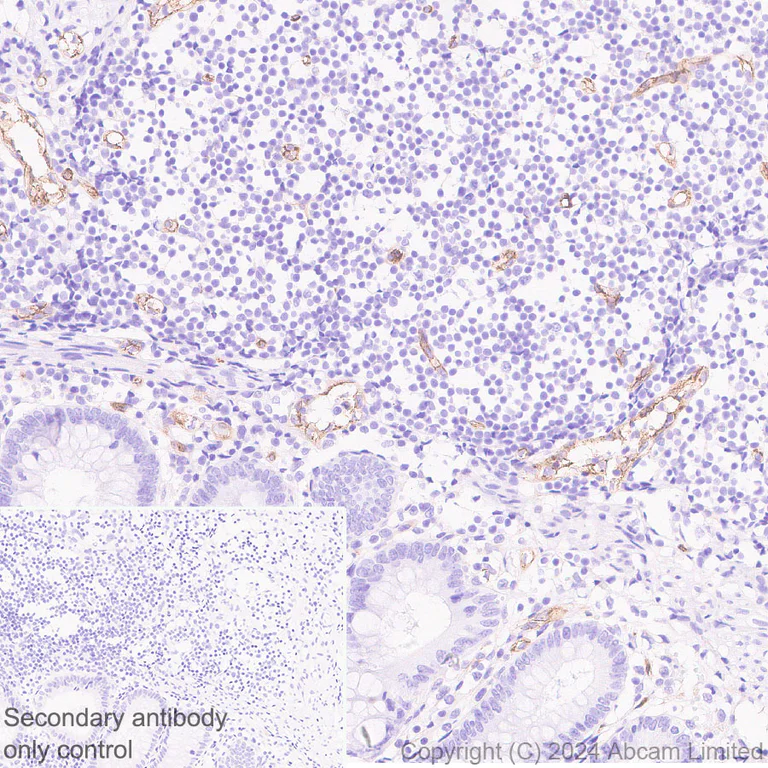 Immunohistochemistry (Formalin/PFA-fixed paraffin-embedded sections) - Anti-PLVAP/PV-1 antibody [EPR29045-558] - BSA and Azide free (AB321890)