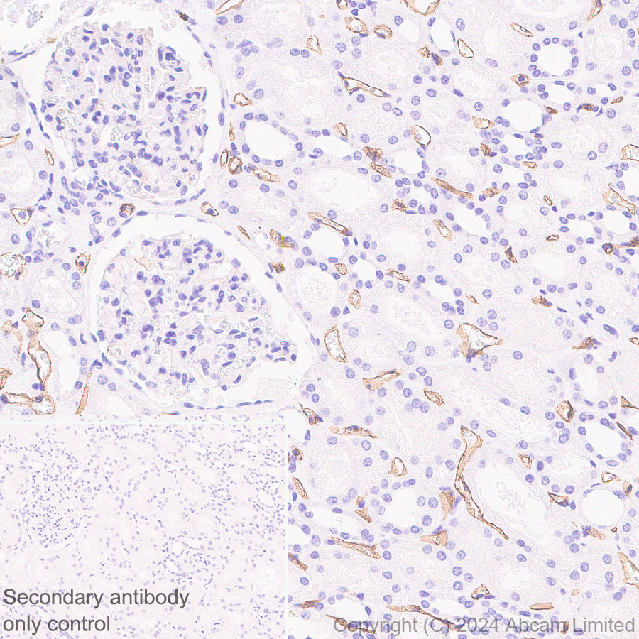 Immunohistochemistry (Formalin/PFA-fixed paraffin-embedded sections) - Anti-PLVAP/PV-1 antibody [EPR29045-558] - BSA and Azide free (AB321890), expandable thumbnail