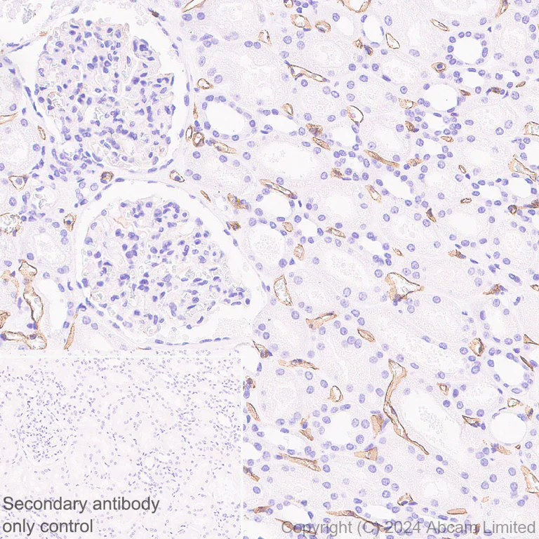Immunohistochemistry (Formalin/PFA-fixed paraffin-embedded sections) - Anti-PLVAP/PV-1 antibody [EPR29045-558] - BSA and Azide free (AB321890)