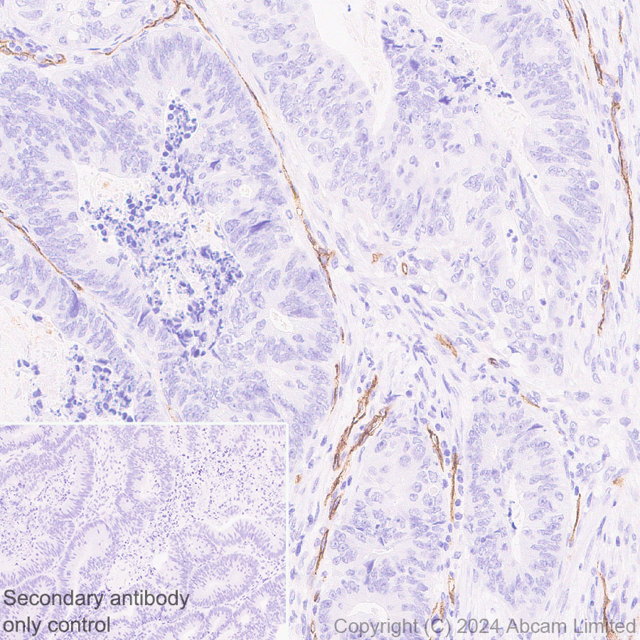 Immunohistochemistry (Formalin/PFA-fixed paraffin-embedded sections) - Anti-PLVAP/PV-1 antibody [EPR29045-558] - BSA and Azide free (AB321890), expandable thumbnail