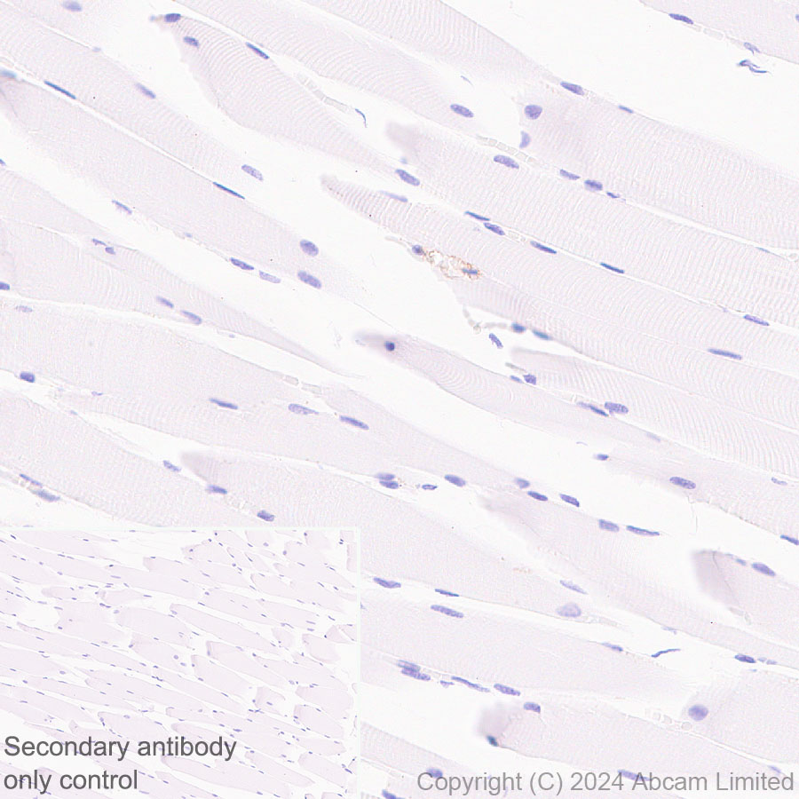 Immunohistochemistry (Formalin/PFA-fixed paraffin-embedded sections) - Anti-PLVAP/PV-1 antibody [EPR29045-558] - BSA and Azide free (AB321890), expandable thumbnail
