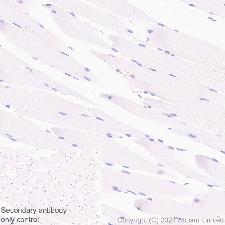 Immunohistochemistry (Formalin/PFA-fixed paraffin-embedded sections) - Anti-PLVAP/PV-1 antibody [EPR29045-558] - BSA and Azide free (AB321890)