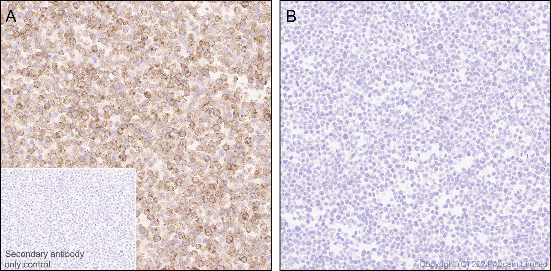 Immunohistochemistry (Formalin/PFA-fixed paraffin-embedded sections) - Anti-PLVAP/PV-1 antibody [EPR29045-558] - BSA and Azide free (AB321890), expandable thumbnail