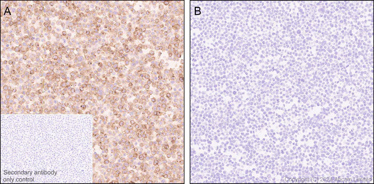 Immunohistochemistry (Formalin/PFA-fixed paraffin-embedded sections) - Anti-PLVAP/PV-1 antibody [EPR29045-558] - BSA and Azide free (AB321890)