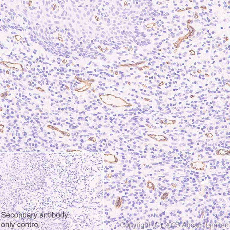Immunohistochemistry (Formalin/PFA-fixed paraffin-embedded sections) - Anti-PLVAP/PV-1 antibody [EPR29045-583] (AB323706)