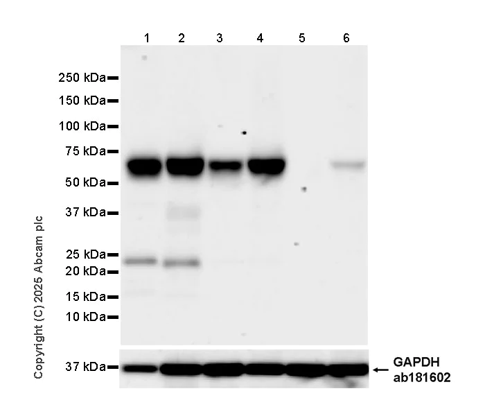 Western blot - Anti-PLVAP/PV-1 antibody [EPR29045-583] (AB323706)