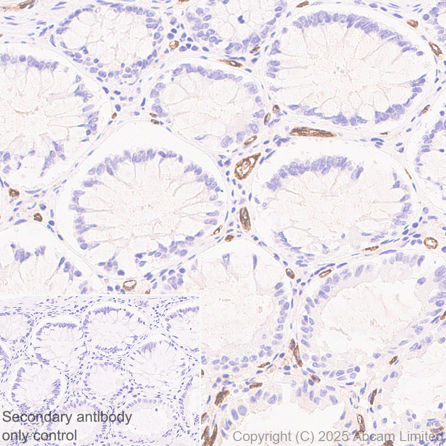 Immunohistochemistry (Formalin/PFA-fixed paraffin-embedded sections) - Anti-PLVAP/PV-1 antibody [EPR29045-583] - BSA and Azide free (AB323707), expandable thumbnail