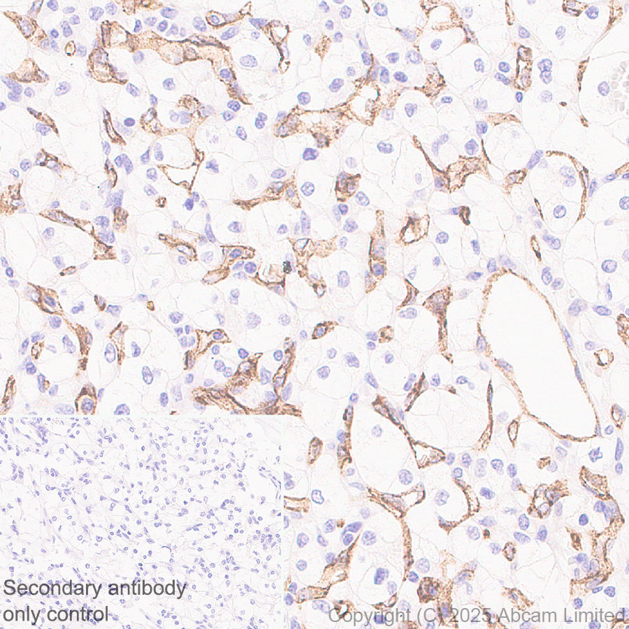 Immunohistochemistry (Formalin/PFA-fixed paraffin-embedded sections) - Anti-PLVAP/PV-1 antibody [EPR29045-583] - BSA and Azide free (AB323707), expandable thumbnail