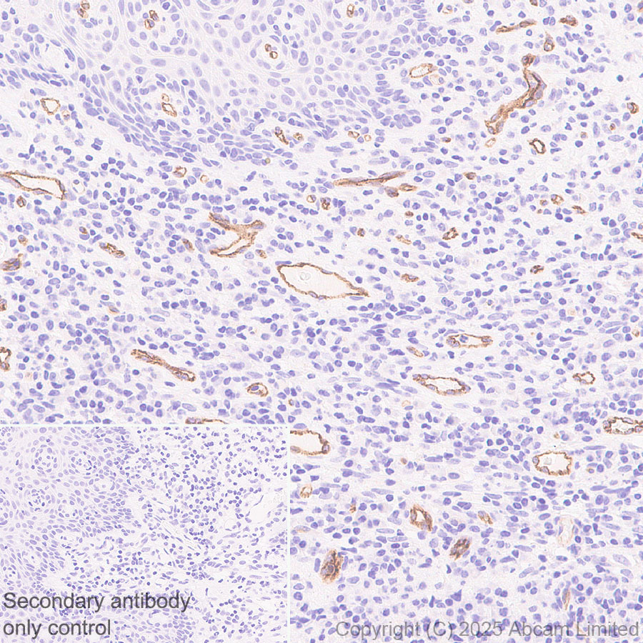 Immunohistochemistry (Formalin/PFA-fixed paraffin-embedded sections) - Anti-PLVAP/PV-1 antibody [EPR29045-583] - BSA and Azide free (AB323707), expandable thumbnail