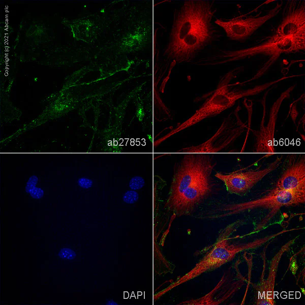Immunocytochemistry/ Immunofluorescence - Anti-PLVAP/PV-1 antibody [MECA-32] - BSA and Azide free (AB256145)