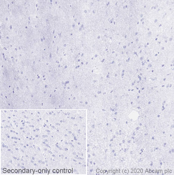 Immunohistochemistry (Frozen sections) - Anti-PLVAP/PV-1 antibody [MECA-32] - BSA and Azide free (AB256145), expandable thumbnail