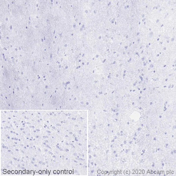 Immunohistochemistry (Frozen sections) - Anti-PLVAP/PV-1 antibody [MECA-32] - BSA and Azide free (AB256145)