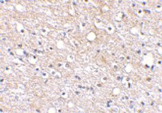 Immunohistochemistry (Formalin/PFA-fixed paraffin-embedded sections) - Anti-Plxdc2 antibody (AB67225)