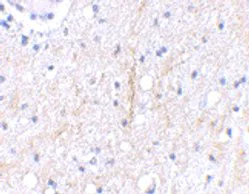 Immunohistochemistry (Formalin/PFA-fixed paraffin-embedded sections) - Anti-Plxdc2 antibody (AB67226)