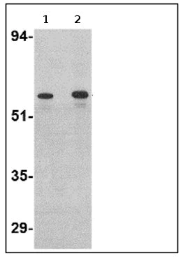 Western blot - Anti-Plxdc2 antibody (AB67226)