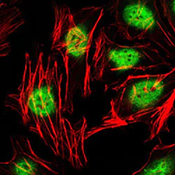 Immunocytochemistry/ Immunofluorescence - Anti-Plzf antibody [5B3] (AB104854)